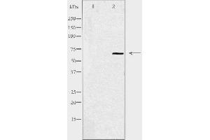 Western blot analysis of extracts from HepG2 cells using YAP antibody.