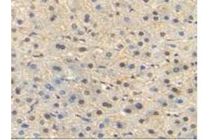 IHC-P analysis of Human Liver Tissue, with DAB staining. (HSP70 1A antibody  (AA 1-641))