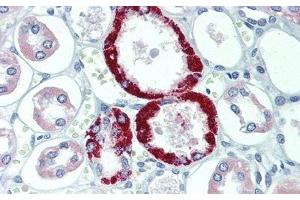 Immunohistochemistry (IHC) image for anti-Transient Receptor Potential Cation Channel, Subfamily C, Member 6 (TRPC6) (AA 1-192) antibody (ABIN7441304)