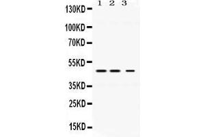 Western blot analysis of Perilipin 3 expression in rat liver extract ( Lane 1), mouse kidney extract ( Lane 2) and HELA whole cell lysates ( Lane 3). (PLIN3 antibody  (C-Term))