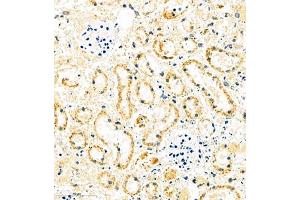 Immunohistochemistry of paraffin embedded mouse ischemic kidney using MUC20 (ABIN7074692) at dilution of 1:1000 (400x lens) (MUC20 antibody)