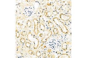 Immunohistochemistry of paraffin embedded mouse ischemic kidney using MUC20 (ABIN7074692) at dilution of 1:1000 (400x lens)