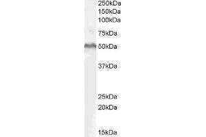 ABIN185607 (1µg/ml) staining of MOLT4 lysate (35µg protein in RIPA buffer). (LEF1 antibody  (Internal Region))