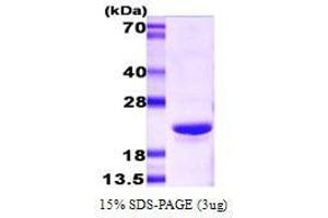 Figure annotation denotes ug of protein loaded and % gel used. (CRYAB Protein (AA 1-175))