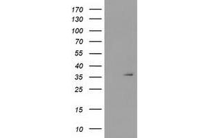 Image no. 1 for anti-Short Chain Dehydrogenase/reductase Family 9C, Member 7 (SDR9C7) antibody (ABIN1500848) (SDR9C7 antibody)
