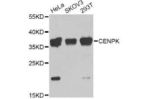 Western blot analysis of extracts of various cell lines, using CENPK Antibody (ABIN5975309) at 1/1000 dilution. (CENPK antibody)