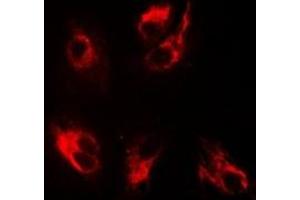 Immunofluorescent analysis of BMPR1B staining in MCF7 cells. (BMPR1B antibody)