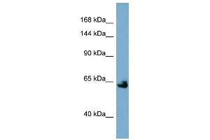 Klotho antibody used at 1 ug/ml to detect target protein. (Klotho antibody  (Middle Region))