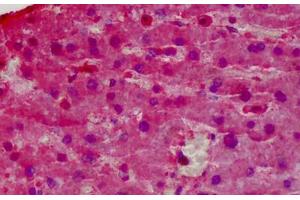 Human Liver: Formalin-Fixed, Paraffin-Embedded (FFPE) (Glutathione Peroxidase 1 antibody  (AA 127-193))