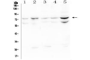 Western blot analysis of OLMF4 using anti-OLMF4 antibody (ABIN6719350). (Olfactomedin 4 antibody  (AA 91-510))