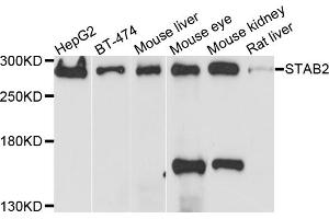 Western blot analysis of extracts of various cell lines, using STAB2 antibody.