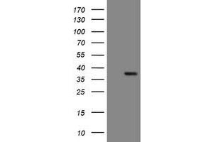 Image no. 1 for anti-Snail Family Zinc Finger 2 (SNAI2) antibody (ABIN1500987) (SLUG antibody)