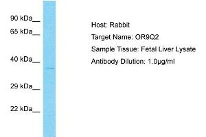 Host: Rabbit Target Name: OR9Q2 Sample Type: Fetal Liver lysates Antibody Dilution: 1. (OR9Q2 antibody  (C-Term))