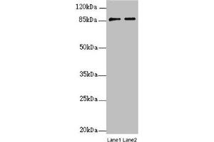 Western blot All lanes: SUPT20H antibody at 0. (SUPT2H (AA 580-779) antibody)