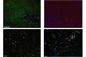 Immunofluorescence detection of endogenous LYVE-1 on rat microvessles using anti-LYVE-1, pAb  (revealed in red) and nuclear stain in blue (right image). (LYVE1 antibody  (AA 24-228))