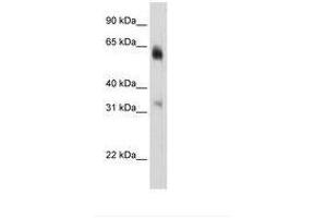 Image no. 3 for anti-Lysine (K)-Specific Demethylase 4D (KDM4D) (C-Term) antibody (ABIN6736292) (JMJD2D antibody  (C-Term))