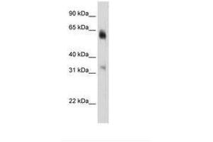 Image no. 3 for anti-Lysine (K)-Specific Demethylase 4D (KDM4D) (C-Term) antibody (ABIN6736292) (JMJD2D antibody  (C-Term))