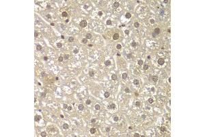Immunohistochemistry of paraffin-embedded mouse liver using MAD1L1 antibody (ABIN5970500) at dilution of 1/100 (40x lens). (MAD1L1 antibody)