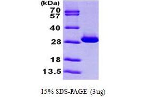 SDS-PAGE (SDS) image for Triosephosphate Isomerase 1 (TPI1) (AA 1-249) protein (His tag) (ABIN667249) (TPI1 Protein (AA 1-249) (His tag))