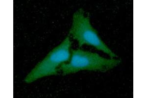 anti-N-Acetylneuraminic Acid Synthase (NANS) (AA 1-359) antibody