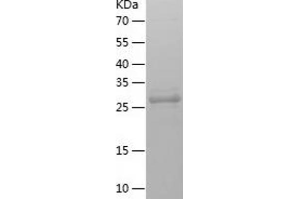 TMEFF1 Protein (AA 40-330) (His tag)