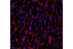Immunofluorescence of paraffin embedded rat heart using CDH19 (ABIN7073258) at dilution of 1:500 (400x lens) (CDH19 antibody)