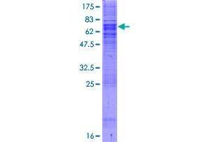 Image no. 1 for Sec61 alpha 1 Subunit (SEC61A1) (AA 1-423) protein (GST tag) (ABIN1319426) (SEC61A1 Protein (AA 1-423) (GST tag))