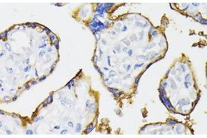 Immunohistochemistry of paraffin-embedded Human placenta using NT5E / CD73 Polyclonal Antibody at dilution of 1:200 (40x lens).