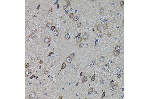 Immunohistochemistry of paraffin-embedded rat brain using UQCRC1 antibody (ABIN5971722) at dilution of 1/100 (40x lens). (UQCRC1 antibody)