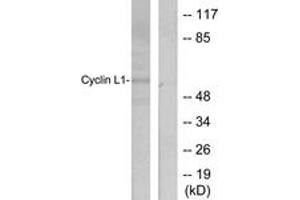 Western blot analysis of extracts from HepG2 cells, using Cyclin L1 Antibody. (Cyclin L1 antibody  (AA 461-510))