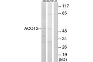 Western blot analysis of extracts from Jurkat/HuvEc cells, using ACOT2 Antibody. (ACOT2 antibody  (AA 171-220))
