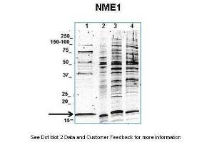 Lanes:  1. (NME1 antibody  (C-Term))