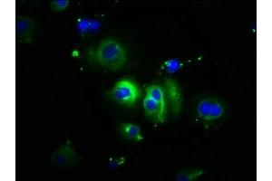 Immunofluorescence staining of MCF-7 cells with ABIN7146190 at 1:100, counter-stained with DAPI.