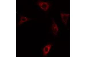 ABIN6275411 staining HepG2 cells by IF/ICC. (PPP1R3C antibody  (N-Term))