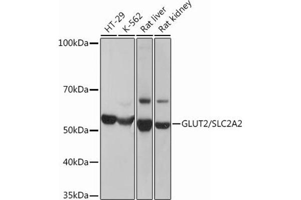 SLC2A2 antibody