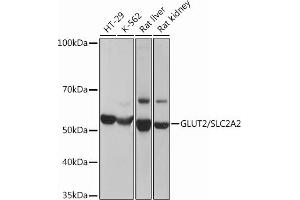 Western blot analysis of extracts of various cell lines, using GLUT2/SLC2 Rabbit mAb (ABIN7270414) at 1:3000 dilution. (SLC2A2 antibody)