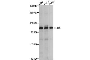 Western blot analysis of extracts of various cell lines, using RDX antibody. (Radixin antibody)