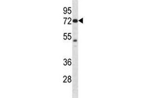 Pak4 antibody western blot analysis in mouse Neuro-2a lysate (PAK4 antibody  (AA 187-216))