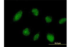 Immunofluorescence of purified MaxPab antibody to TRIM45 on HeLa cell. (TRIM45 antibody  (AA 1-562))