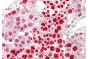 Rabbit Anti-RBPMS antibody  Formalin Fixed Paraffin Embedded Tissue: Human Testis Primary antibody Concentration: 1:100 Secondary Antibody: Donkey anti-Rabbit-Cy3 Secondary Antibody Concentration: 1:200 Magnification: 20x Exposure Time: 0. (RBPMS antibody  (N-Term))