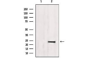 Western blot analysis of extracts from 293, using SM22 aphla Antibody. (Transgelin antibody  (C-Term))