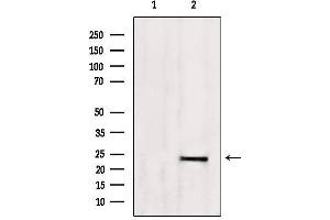 Western blot analysis of extracts from 293, using SM22 aphla Antibody. (Transgelin antibody  (C-Term))