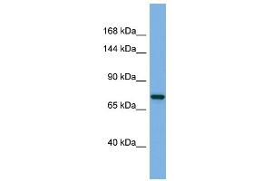 Host:  Rabbit  Target Name:  PR  Sample Type:  ACHN Whole Cell lysates  Antibody Dilution:  1. (PR (N-Term) antibody)