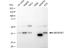 Western blotting analysis using NDUFAF5 antibody (ABIN7798077).