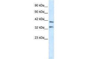 Human Liver; WB Suggested Anti-GSH2 Antibody Titration: 0. (GSX2 antibody  (N-Term))