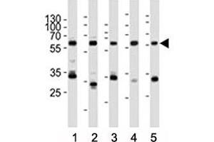 Western blot analysis of lysate from (1) HeLa, (2) rat PC-12, (3) Ramos, (4) mouse NIH3T3 cell line, (5) mouse brain tissue lysate using Pyruvate Kinase/ PKM2 antibody at 1:1000. (PKM2 antibody  (AA 476-505))