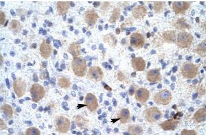 Rabbit Anti-OR13C9 Antibody Catalog Number: ARP31898 Paraffin Embedded Tissue: Human Brain Cellular Data: Neural Cells Antibody Concentration: 4. (OR13C9 antibody  (Middle Region))
