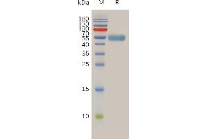 RNF43 Protein (AA 43-197) (mFc Tag)