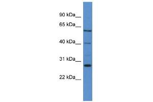 WB Suggested Anti-CYP24A1 Antibody Titration: 0. (CYP24A1 antibody  (C-Term))
