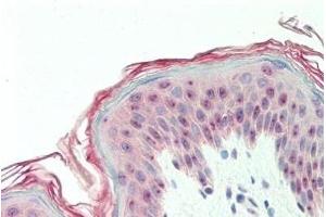 Human, Skin: Formalin-Fixed Paraffin-Embedded (FFPE) (DEGS1 antibody  (N-Term))
